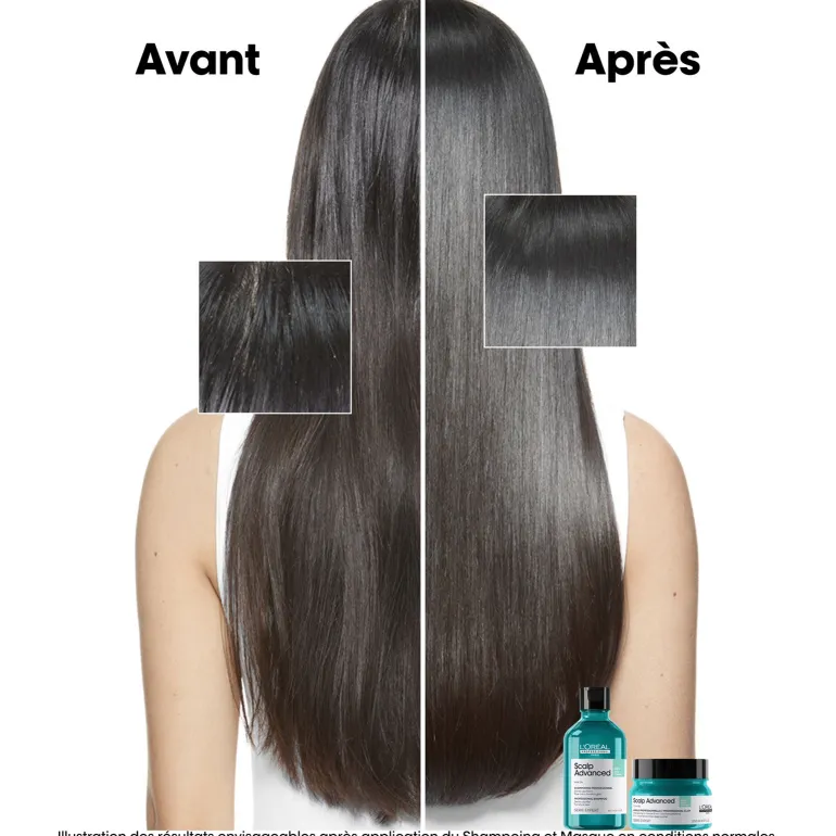 Argile 2-en-1 purifiante anti-gras Scalp Advanced 250ml
