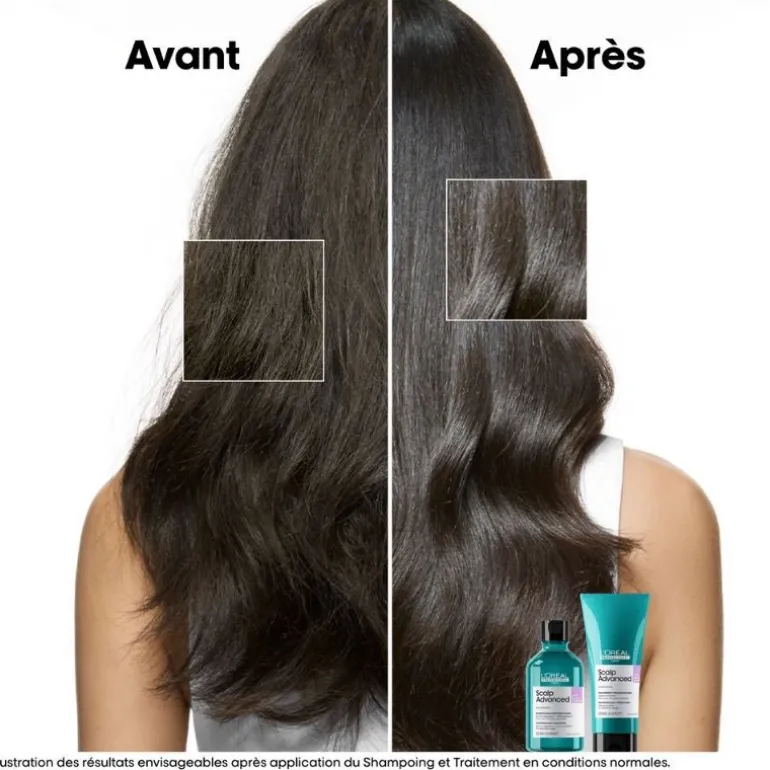 Duo recharge Scalp Advanced + shampooing 500ml