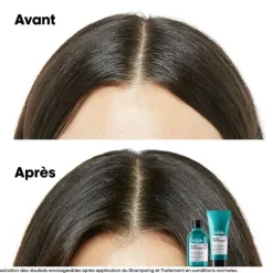 Duo recharge Scalp Advanced + shampooing 500ml