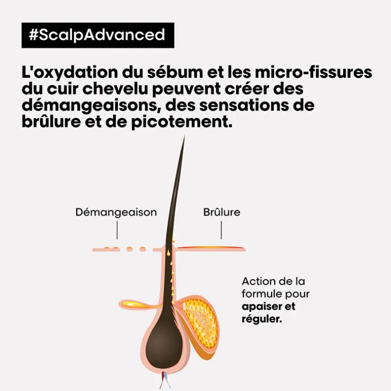 Routine anti-pellicules grasses Scalp Advanced