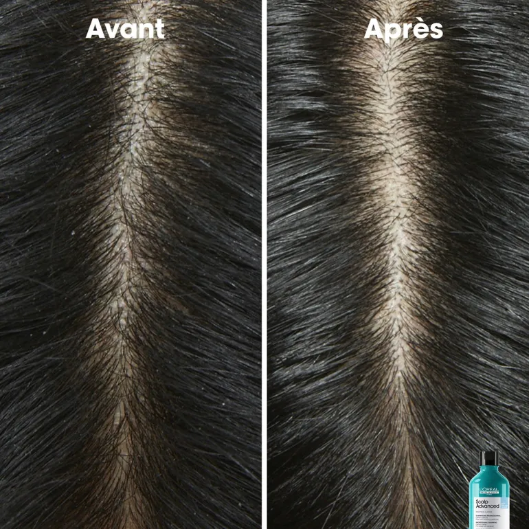Shampooing dermo-clarifiant anti-pelliculaire Scalp Advanced 1500ml