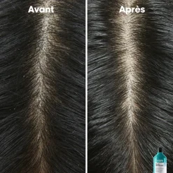 Shampooing dermo-clarifiant anti-pelliculaire Scalp Advanced 300ml