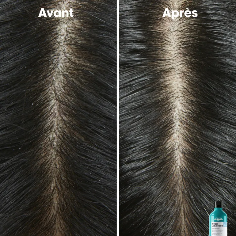 Shampooing dermo-clarifiant anti-pelliculaire Scalp Advanced 300ml