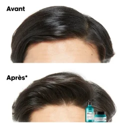 Shampooing dermo-purifiant anti-gras Scalp Advanced 1500ml
