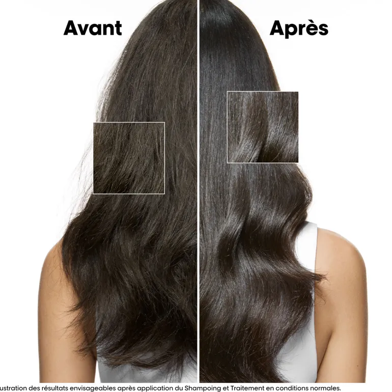 Traitement apaisant intense Scalp Advanced