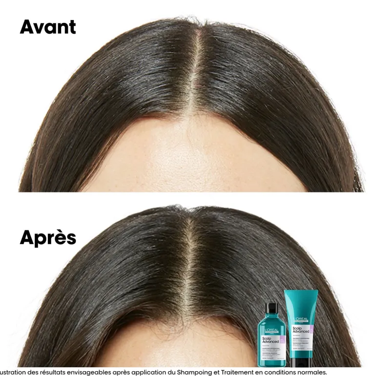 Traitement apaisant intense Scalp Advanced